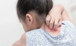 Экзема у детей может спровоцировать депрессию и замкнутость